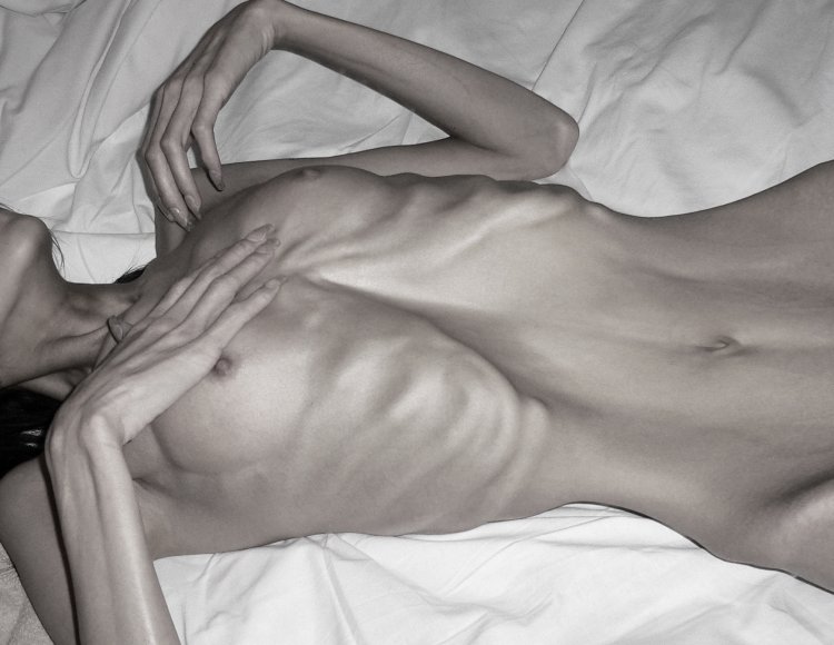 Beautiful figure of anorexics