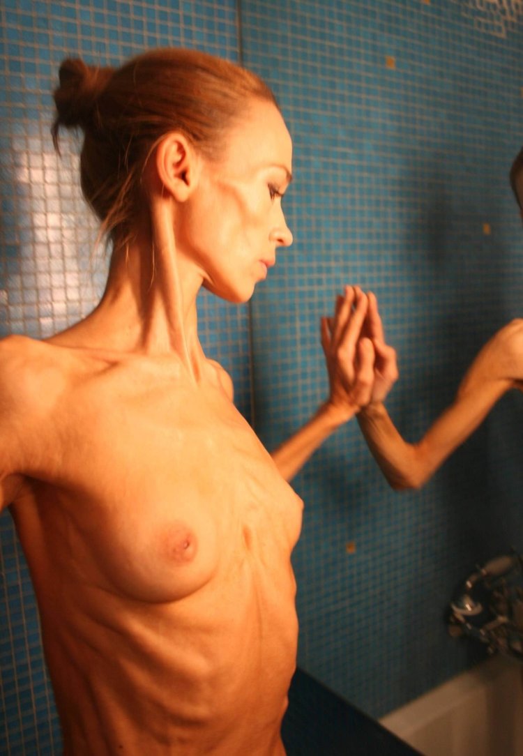 Naked anorexics