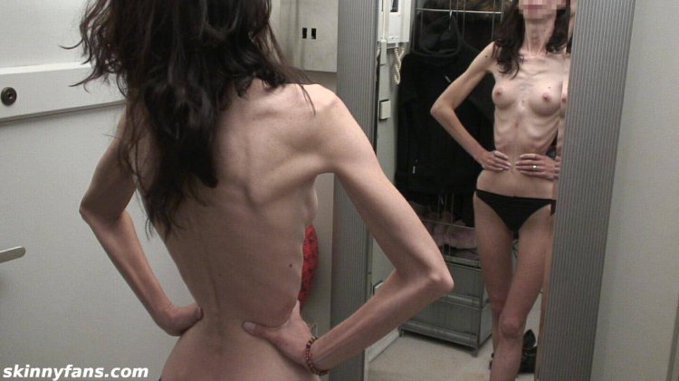 Anorexica