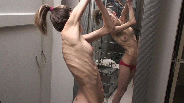 Anorexica