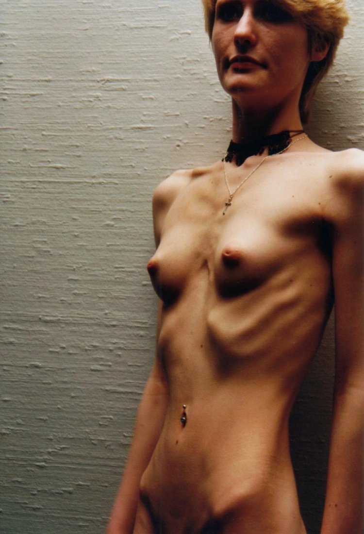 Naked anorexics