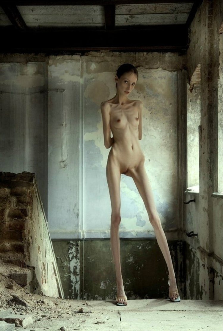 Anorexica is naked